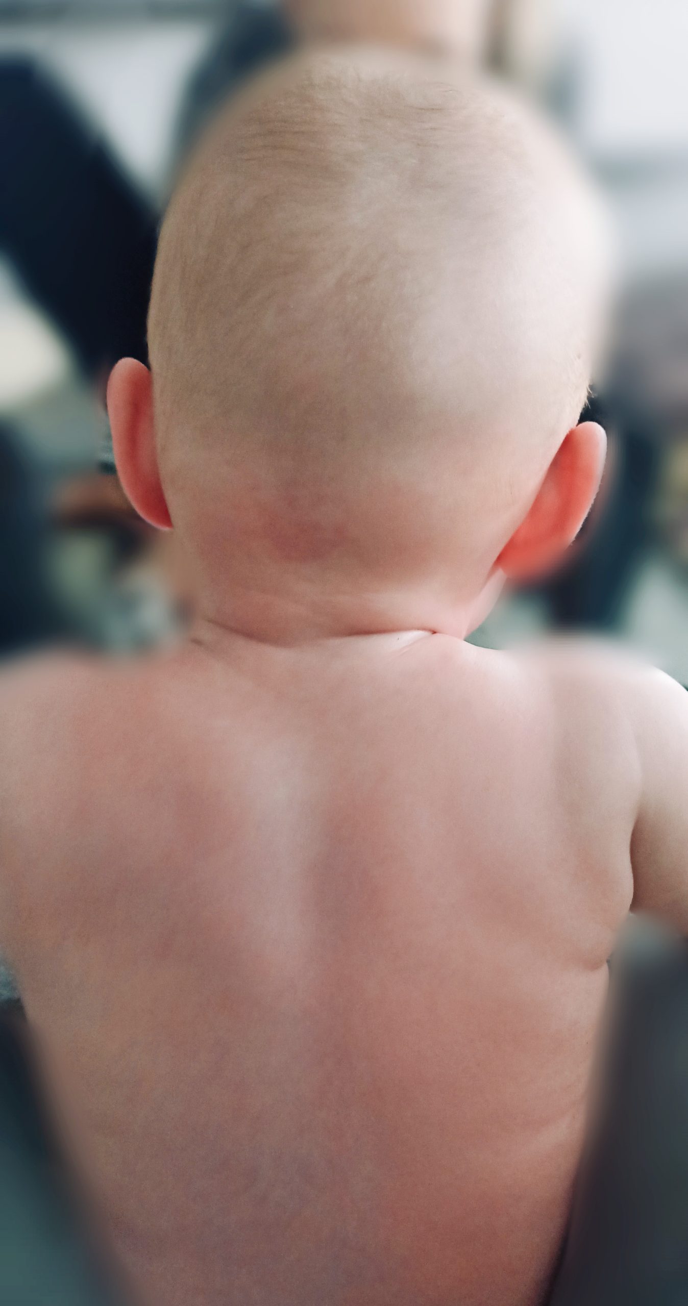 Kreivakaklystė - Image 3